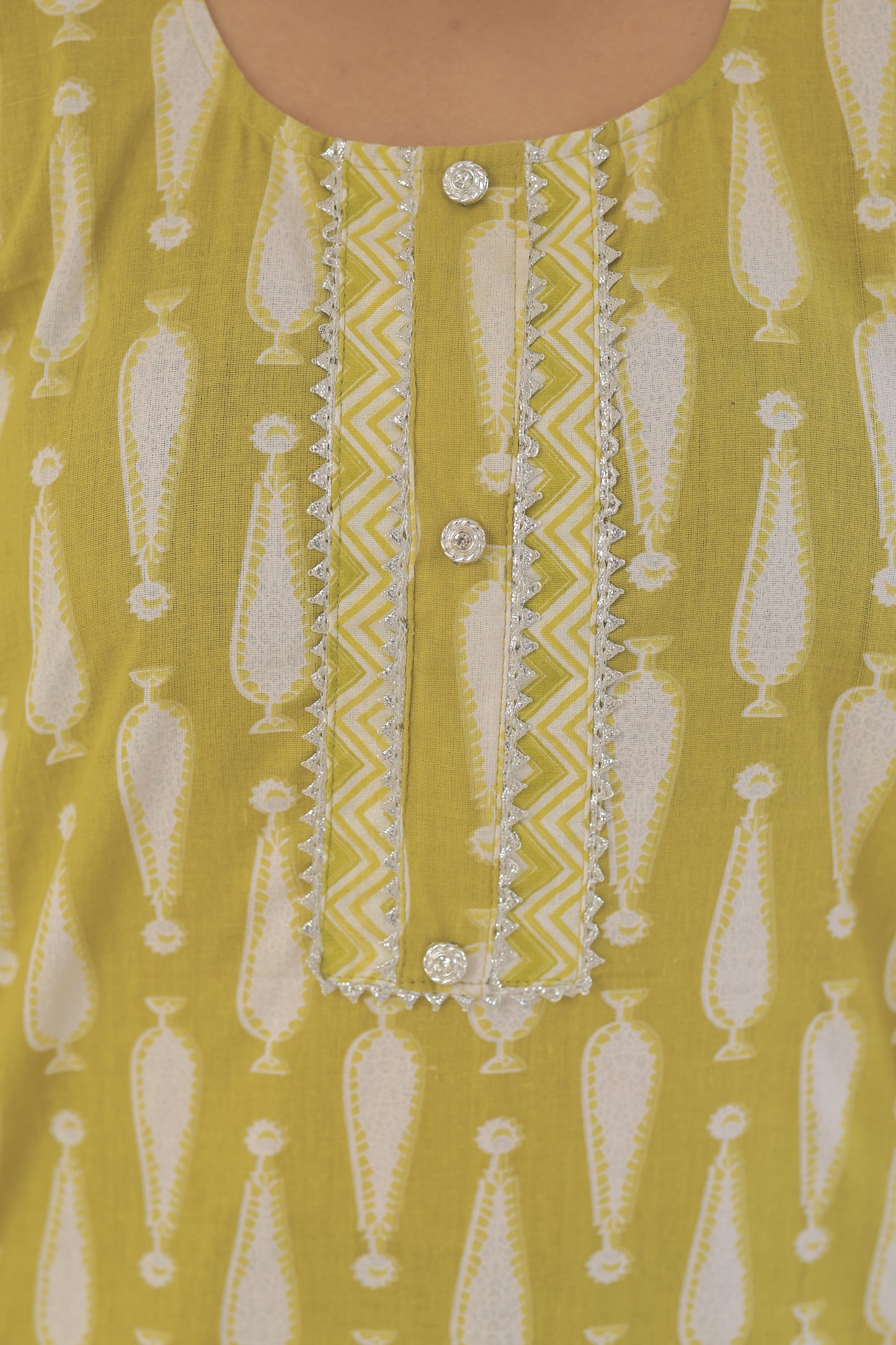 Bright Yellow Casual Kurti with Elegant Patterns"